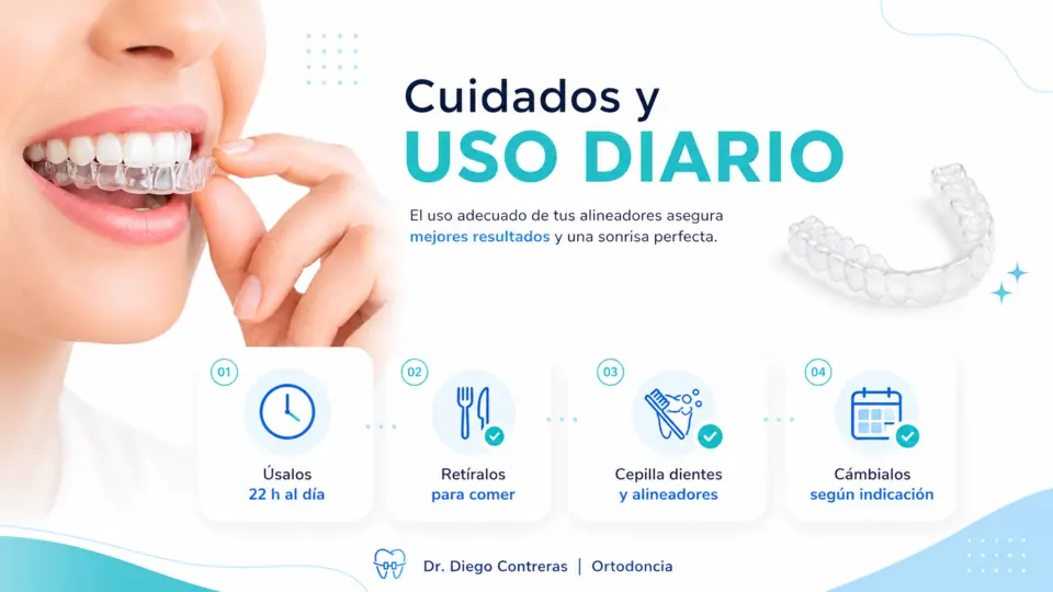 Guía visual para colocar y retirar alineadores