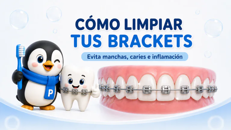 Cómo limpiar los brackets para evitar manchas, caries e inflamación